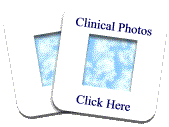 Clinical Photos - Click here!